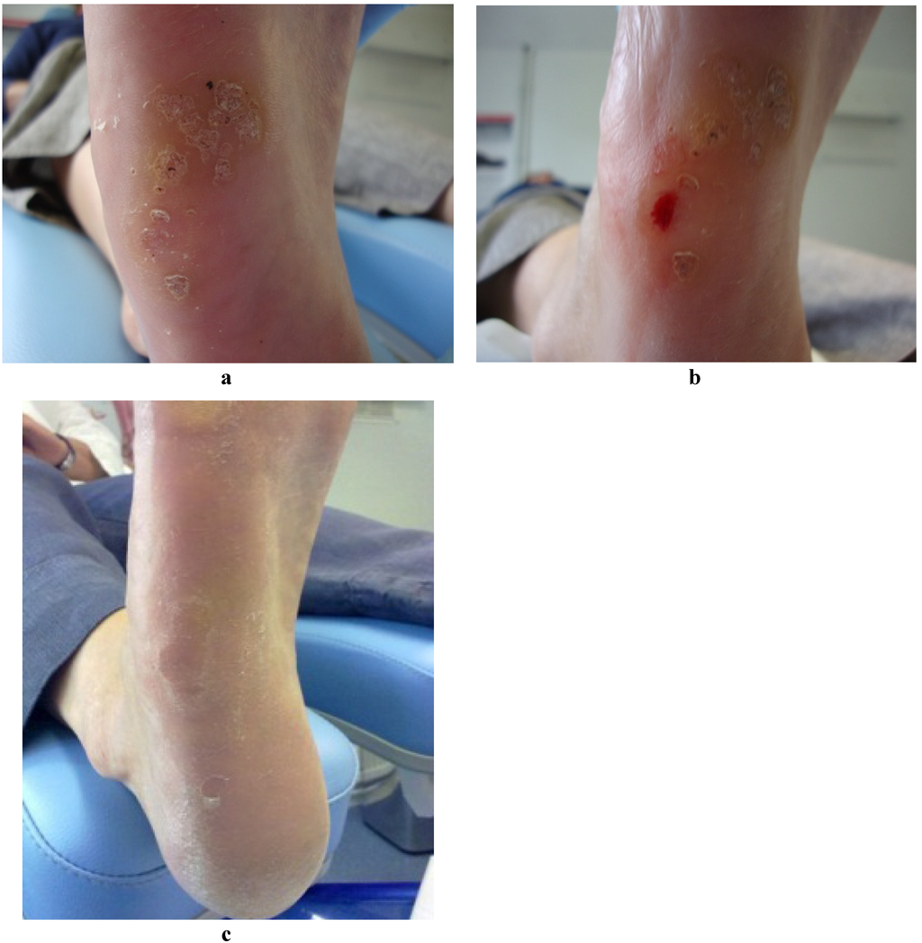 Jcm 02 00013 g003 1024