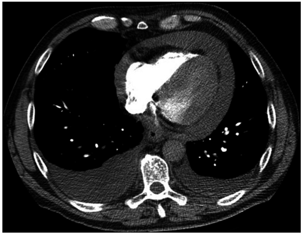 Jcm 04 00075 g001 1024