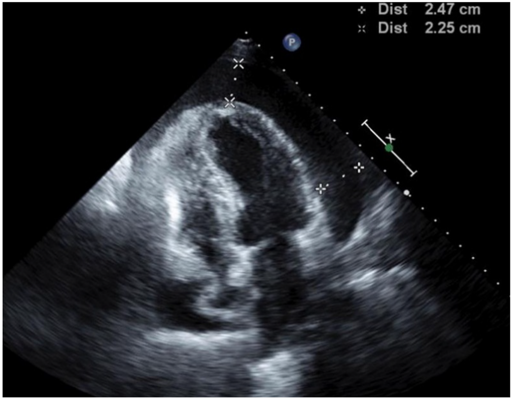 Jcm 04 00075 g002 1024