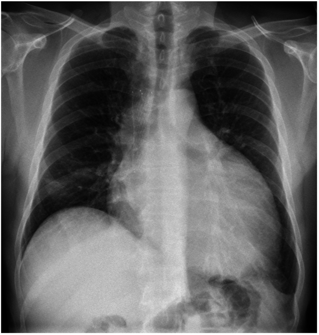 Jcm 04 00075 g003 1024