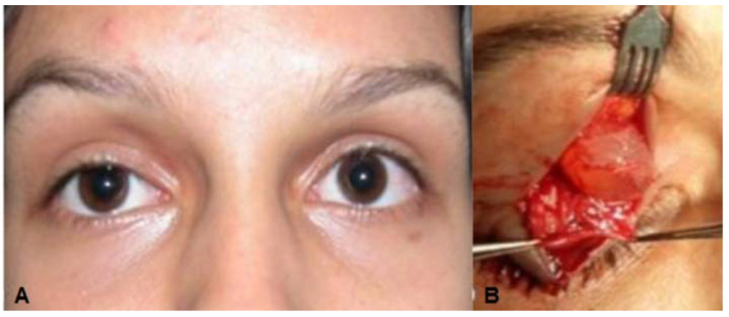 Jcm 04 00150 g002a 1024