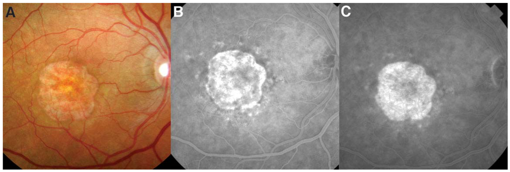 Jcm 04 00343 g002 1024