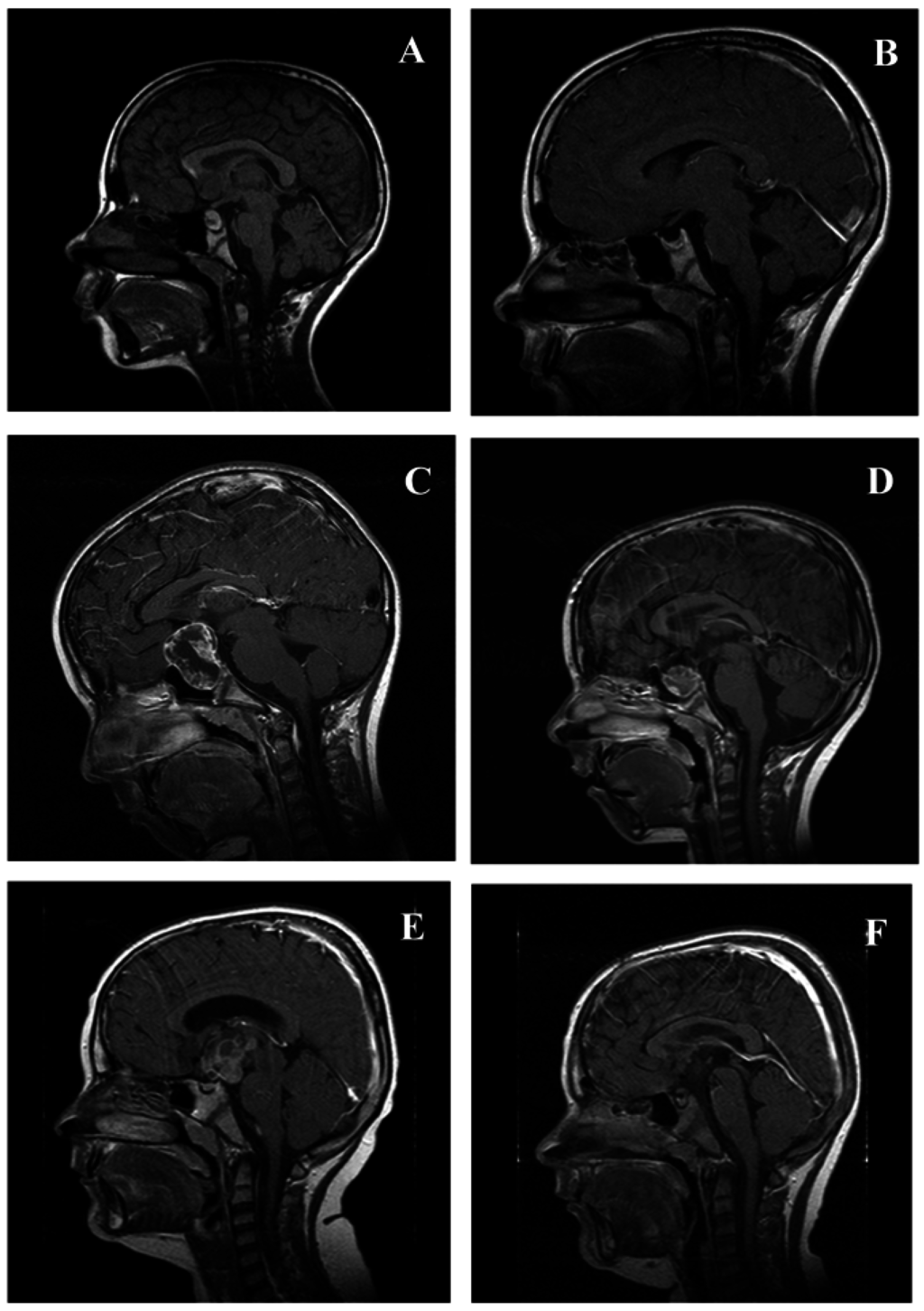 Jcm 04 00389 g004 1024