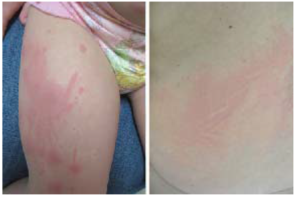 Jcm 04 00884 g005 1024