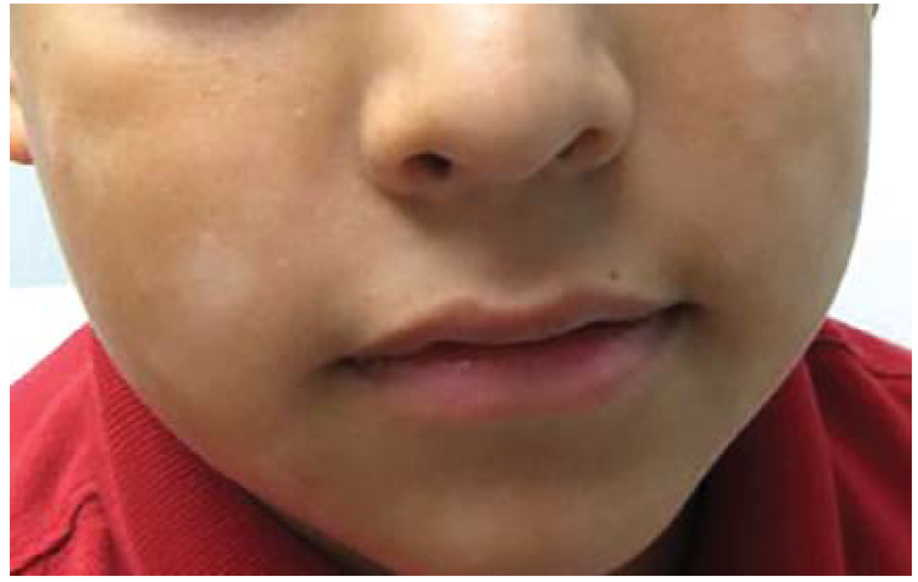 Jcm 04 00884 g007 1024