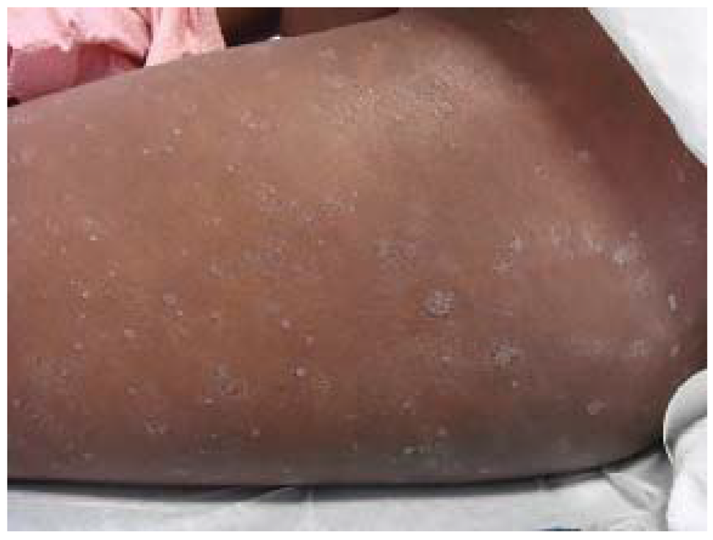 Jcm 04 00884 g008 1024