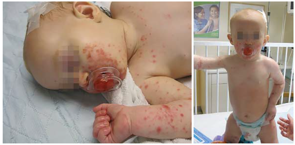 Jcm 04 00884 g014 1024