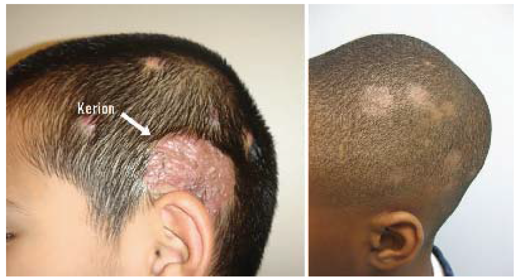 Jcm 04 00884 g018 1024