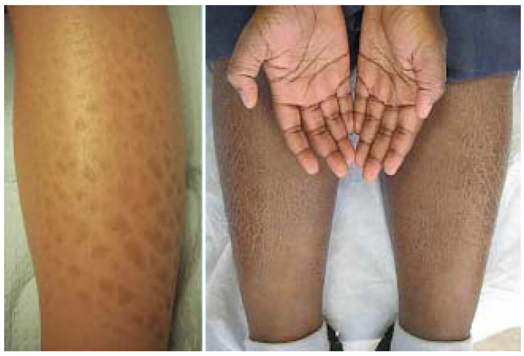 Jcm 04 00884 g023 1024