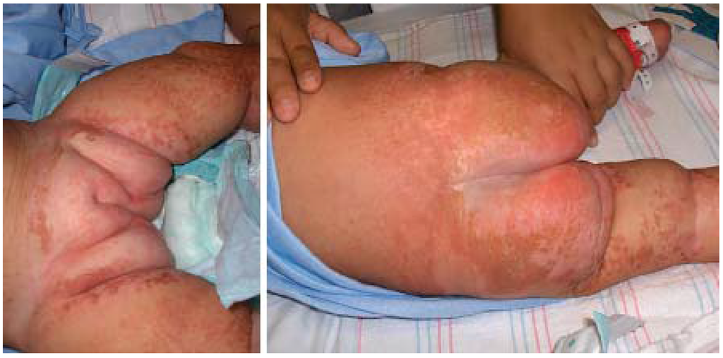 Jcm 04 00884 g024 1024