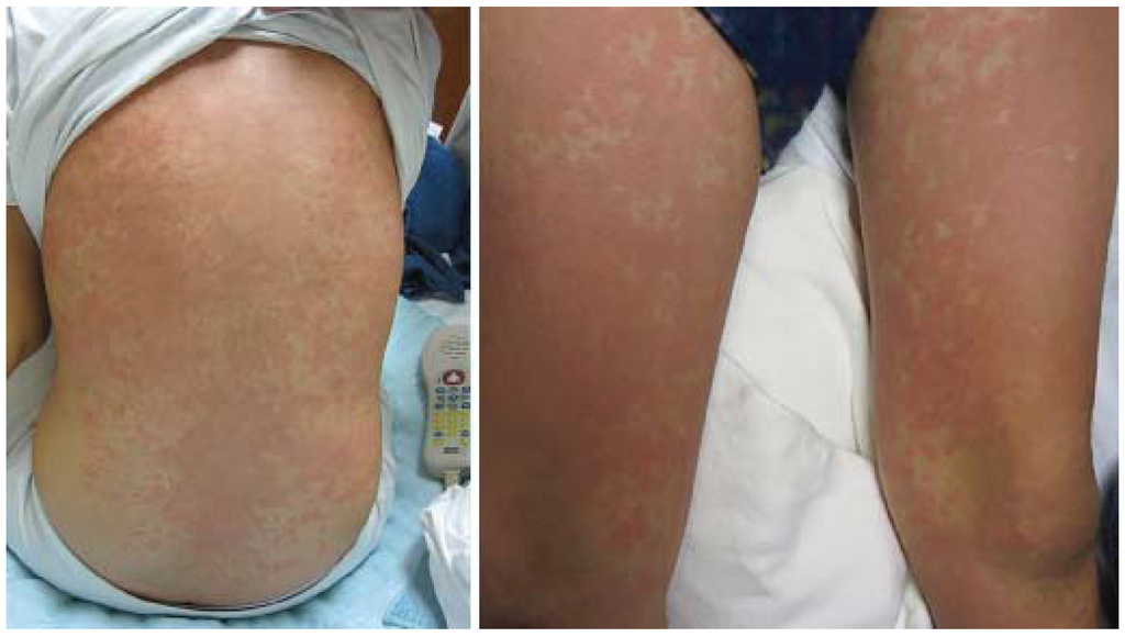 Jcm 04 00884 g025 1024