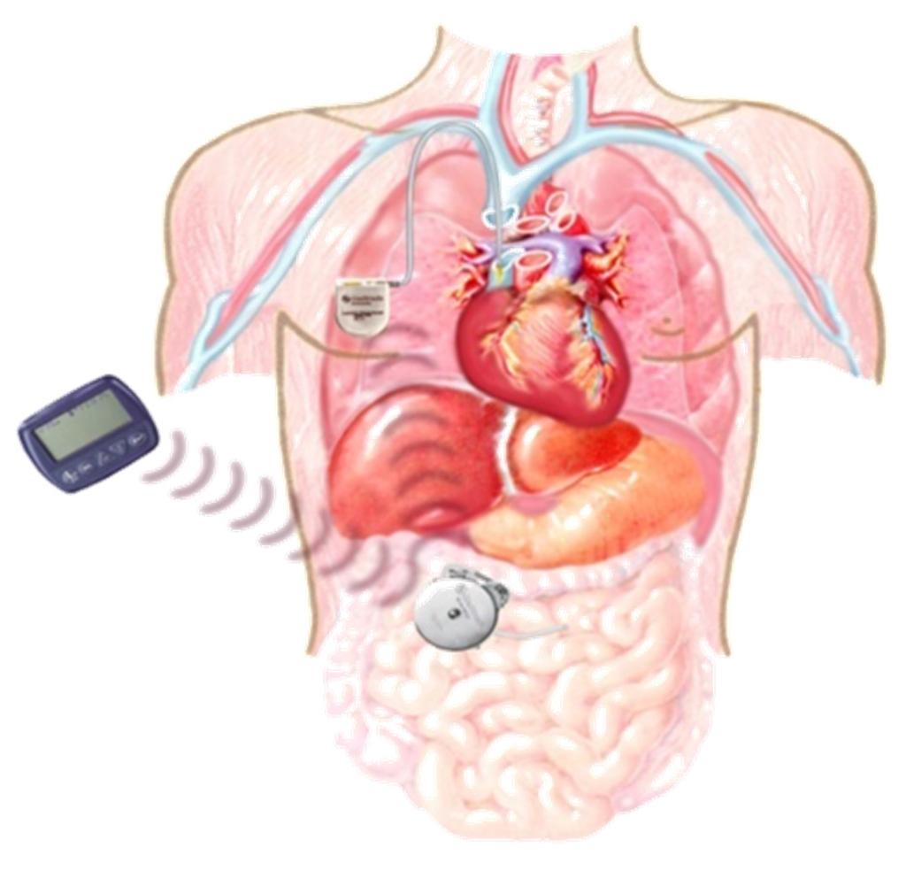 Jcm 05 00005 g010 1024