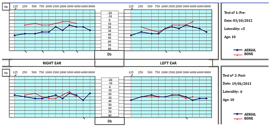 Jcm 05 00014 g001 1024