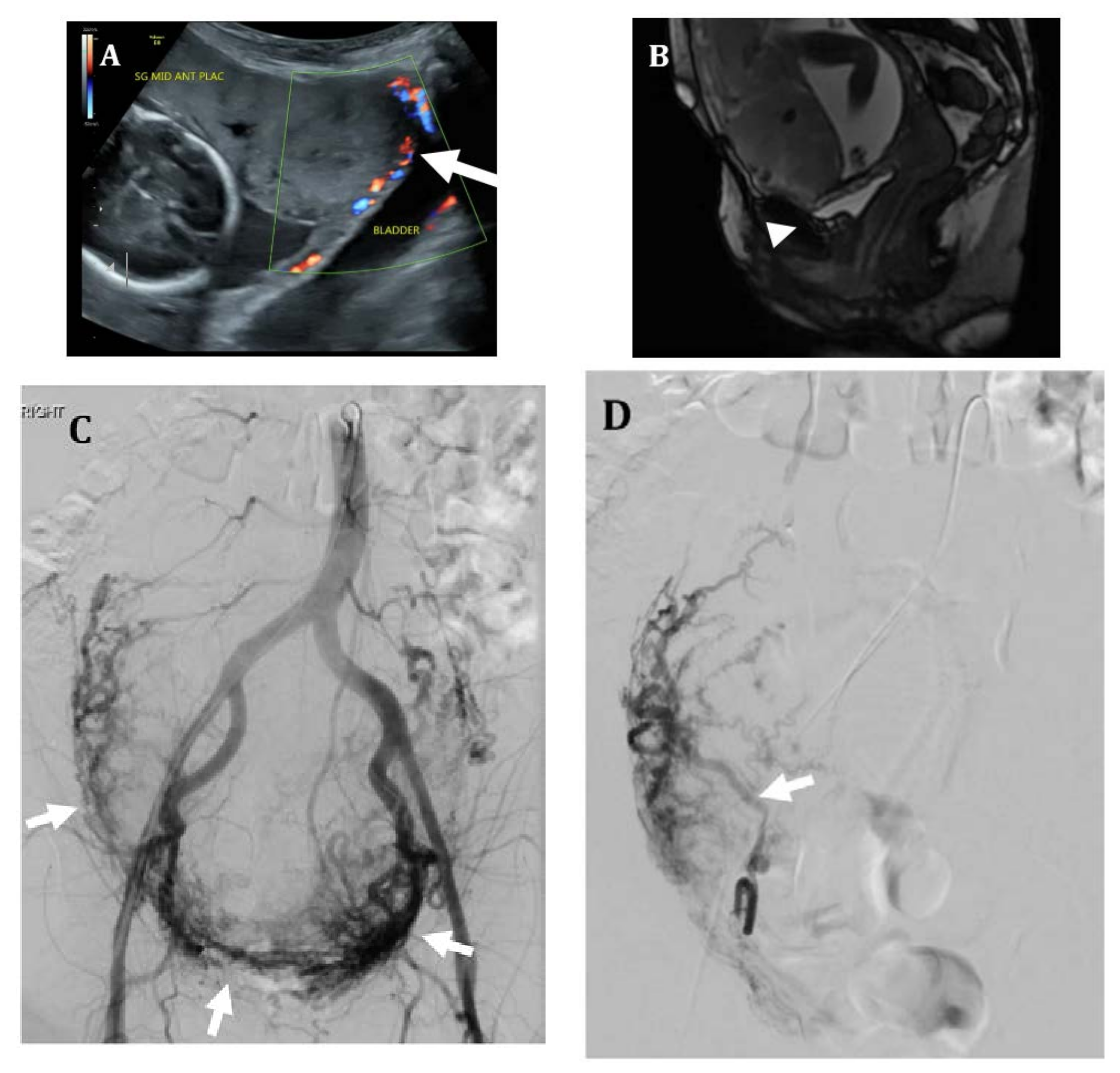 Jcm 07 00092 g003a Jcm 07 00092 g003a