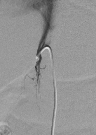 Jcm 07 00114 g005