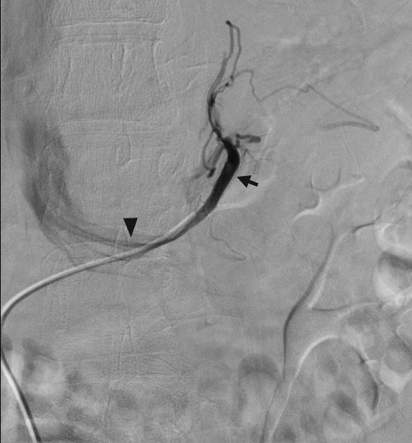 Jcm 07 00114 g006