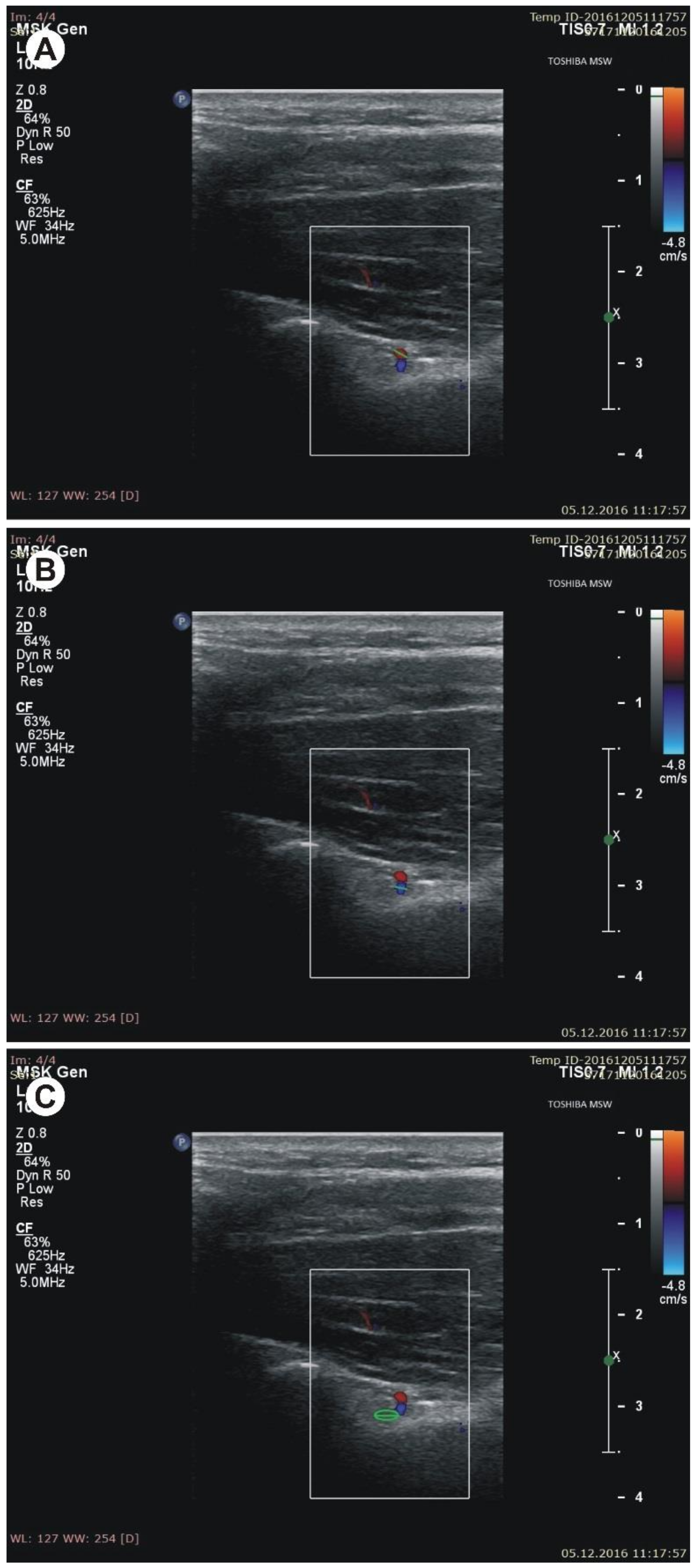 Jcm 07 00491 g003 Jcm 07 00491 g003