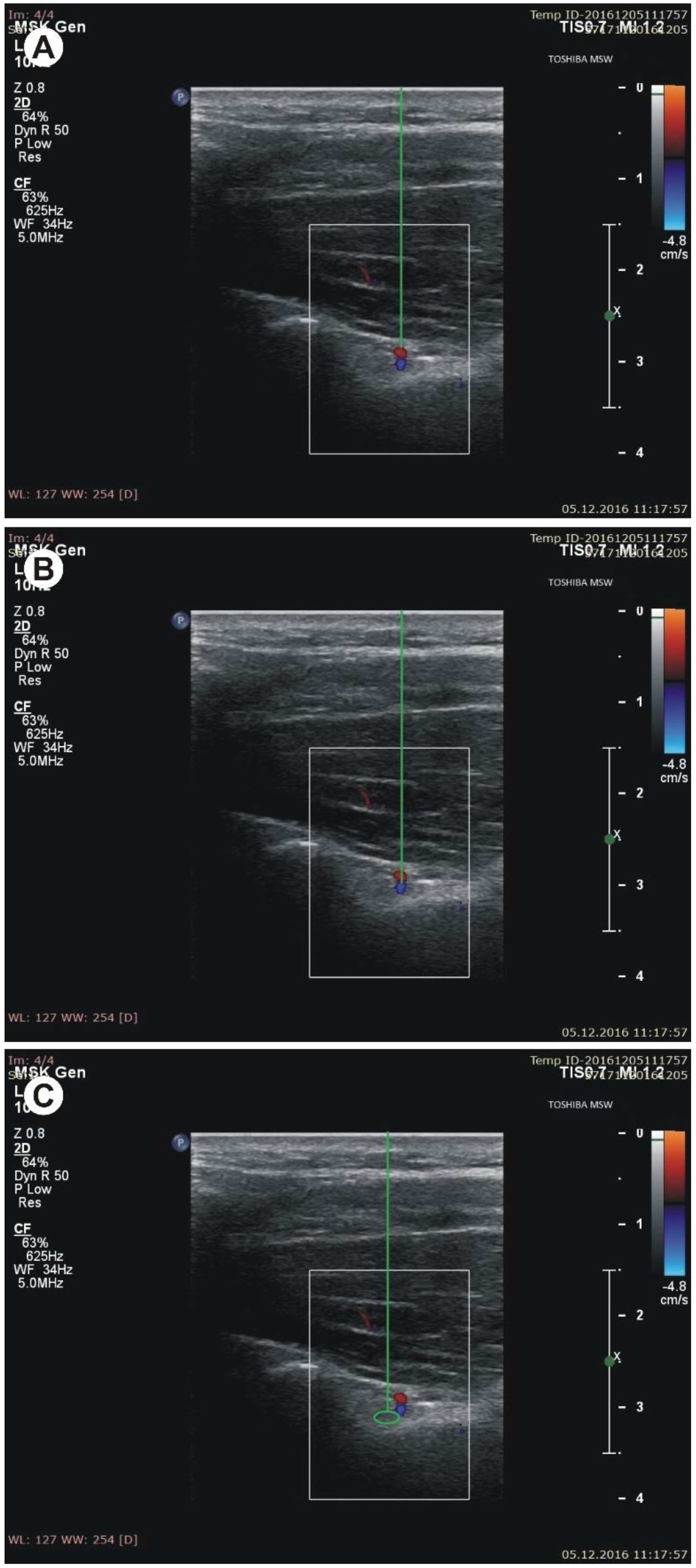 Jcm 07 00491 g004 Jcm 07 00491 g004