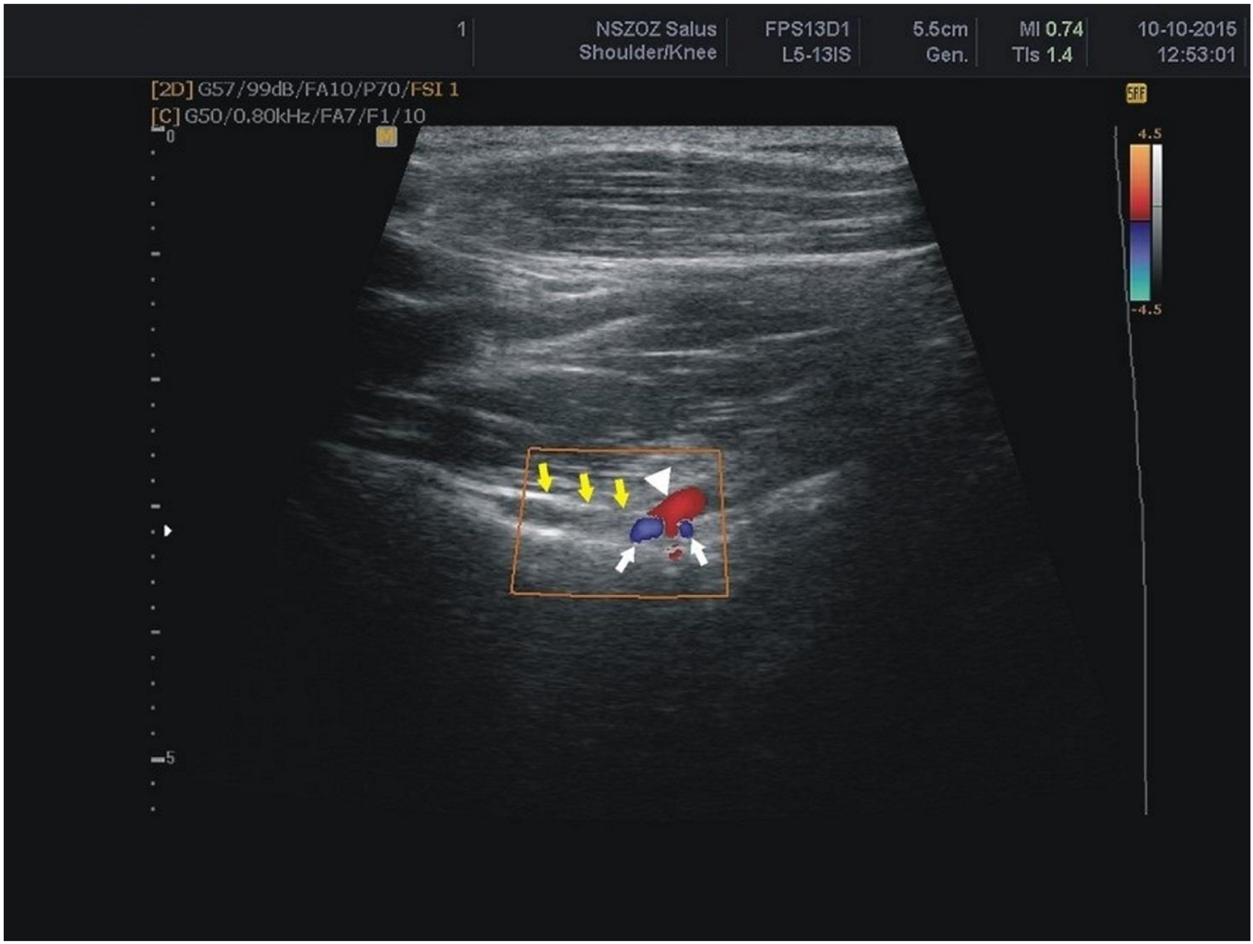 Jcm 07 00491 g006 Jcm 07 00491 g006