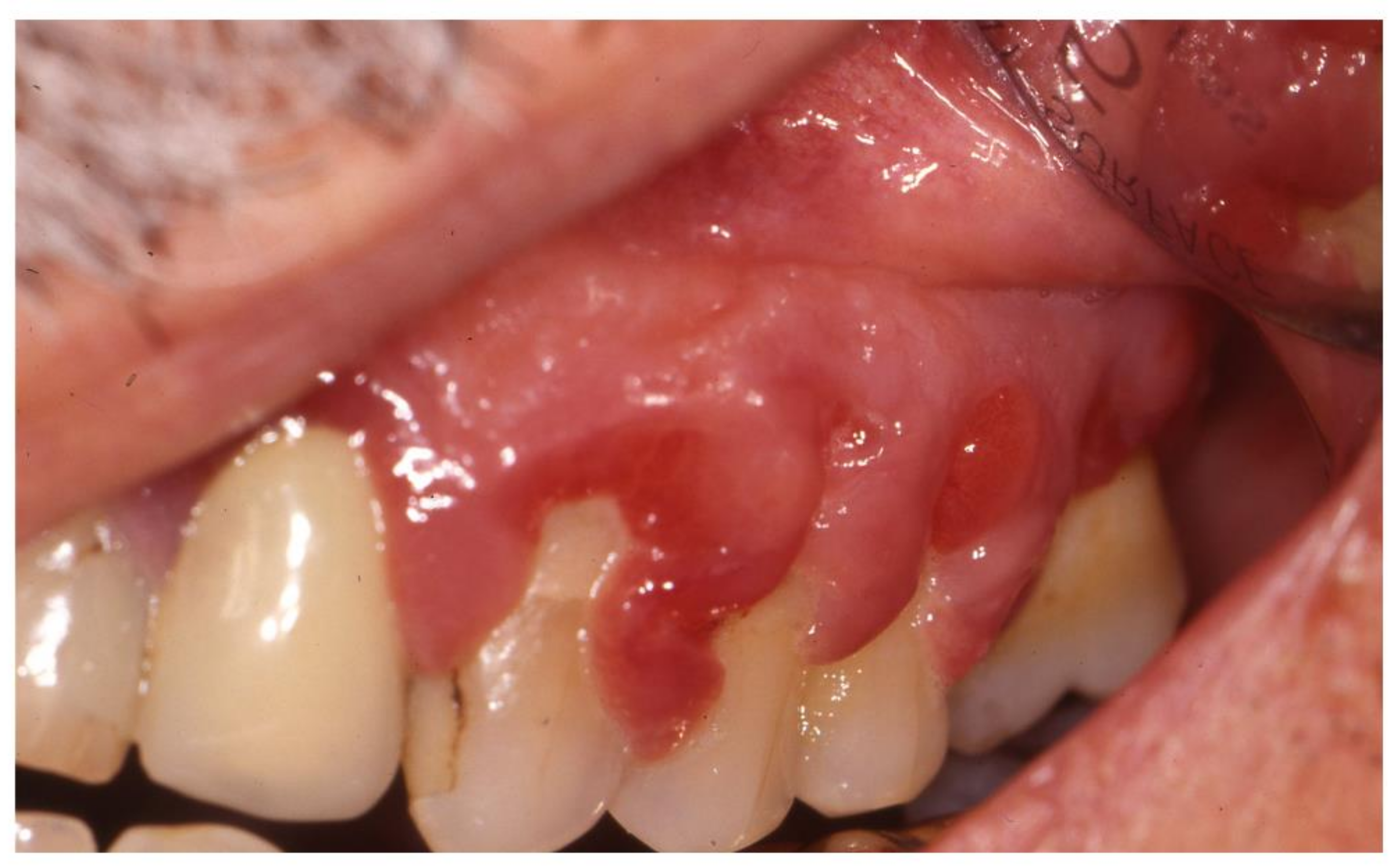 Jcm 08 00021 g005 Jcm 08 00021 g005