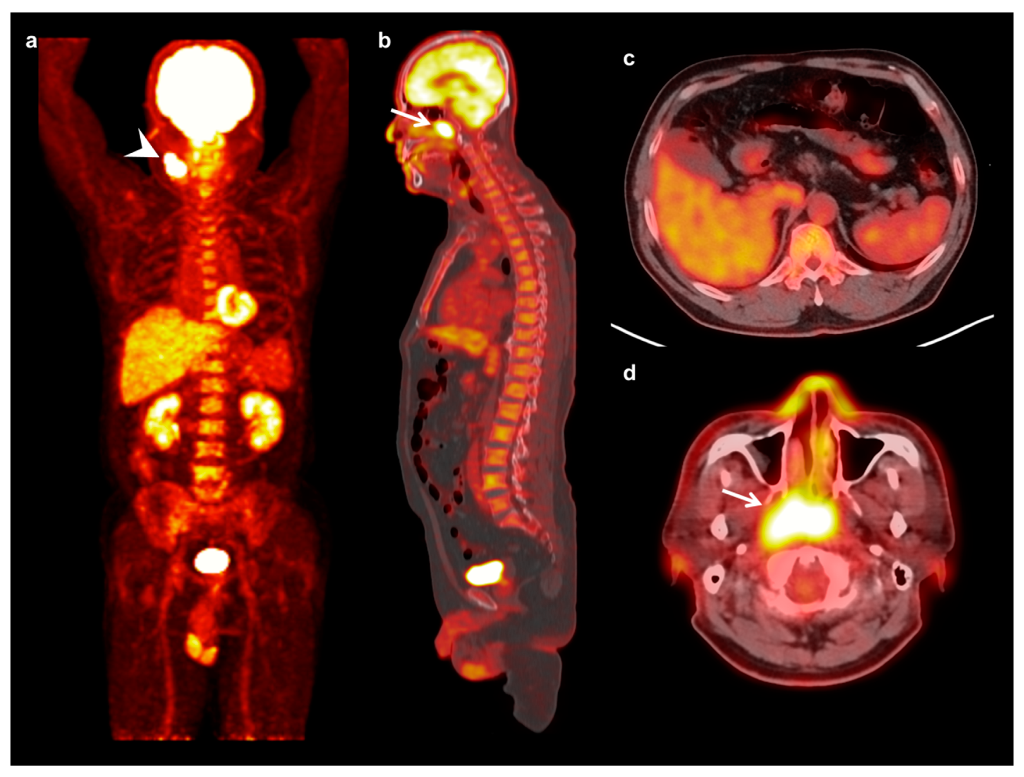 Jcm 08 01169 g002 Jcm 08 01169 g002
