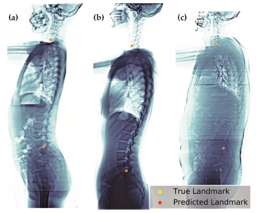 Jcm 08 01826 g011 Jcm 08 01826 g011