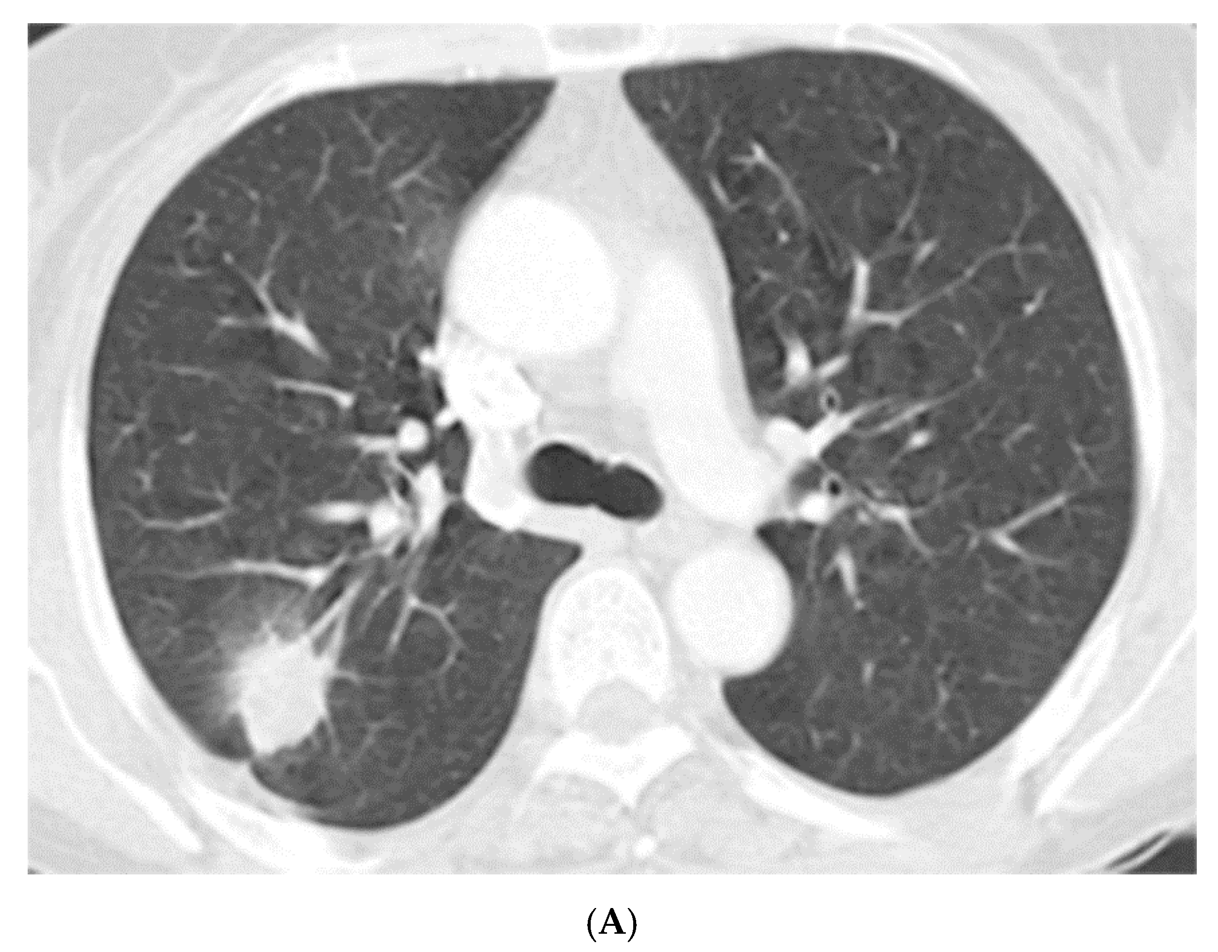 Jcm 08 01898 g001a Jcm 08 01898 g001a