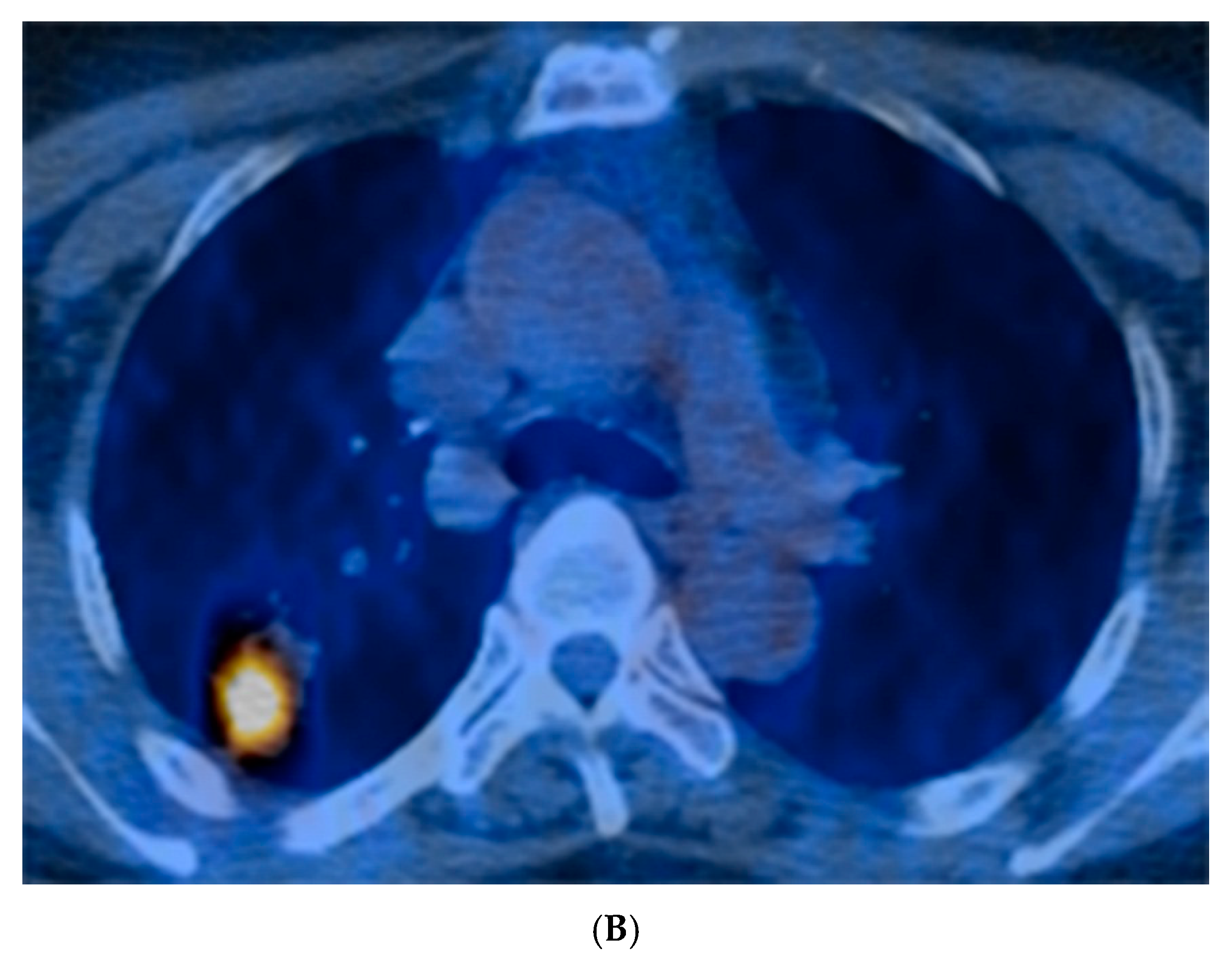 Jcm 08 01898 g001b Jcm 08 01898 g001b