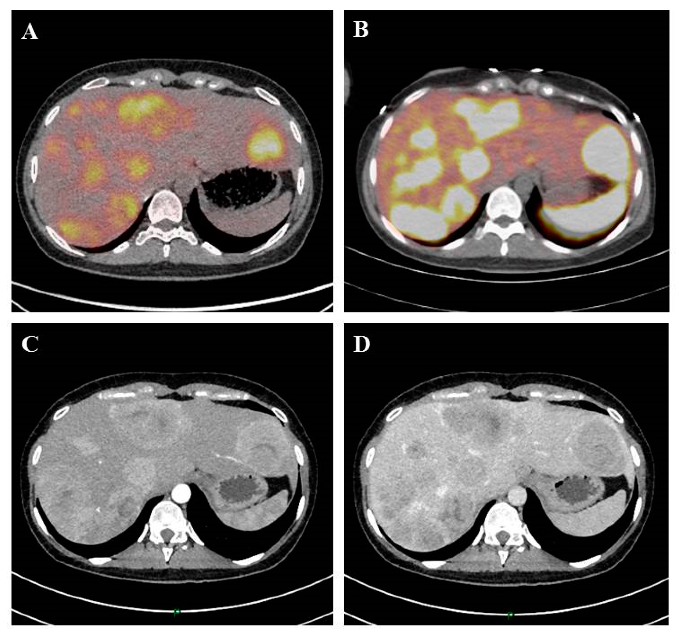 Jcm 08 01907 g001 Jcm 08 01907 g001