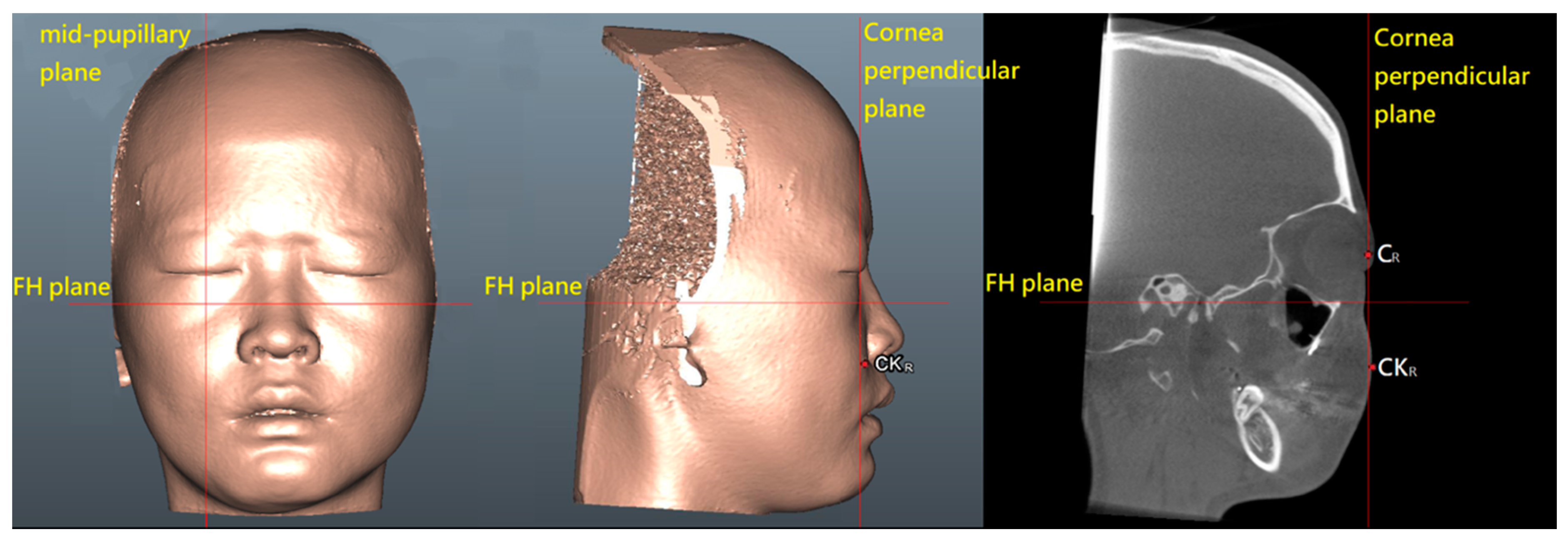 Jcm 09 00262 g006 Jcm 09 00262 g006