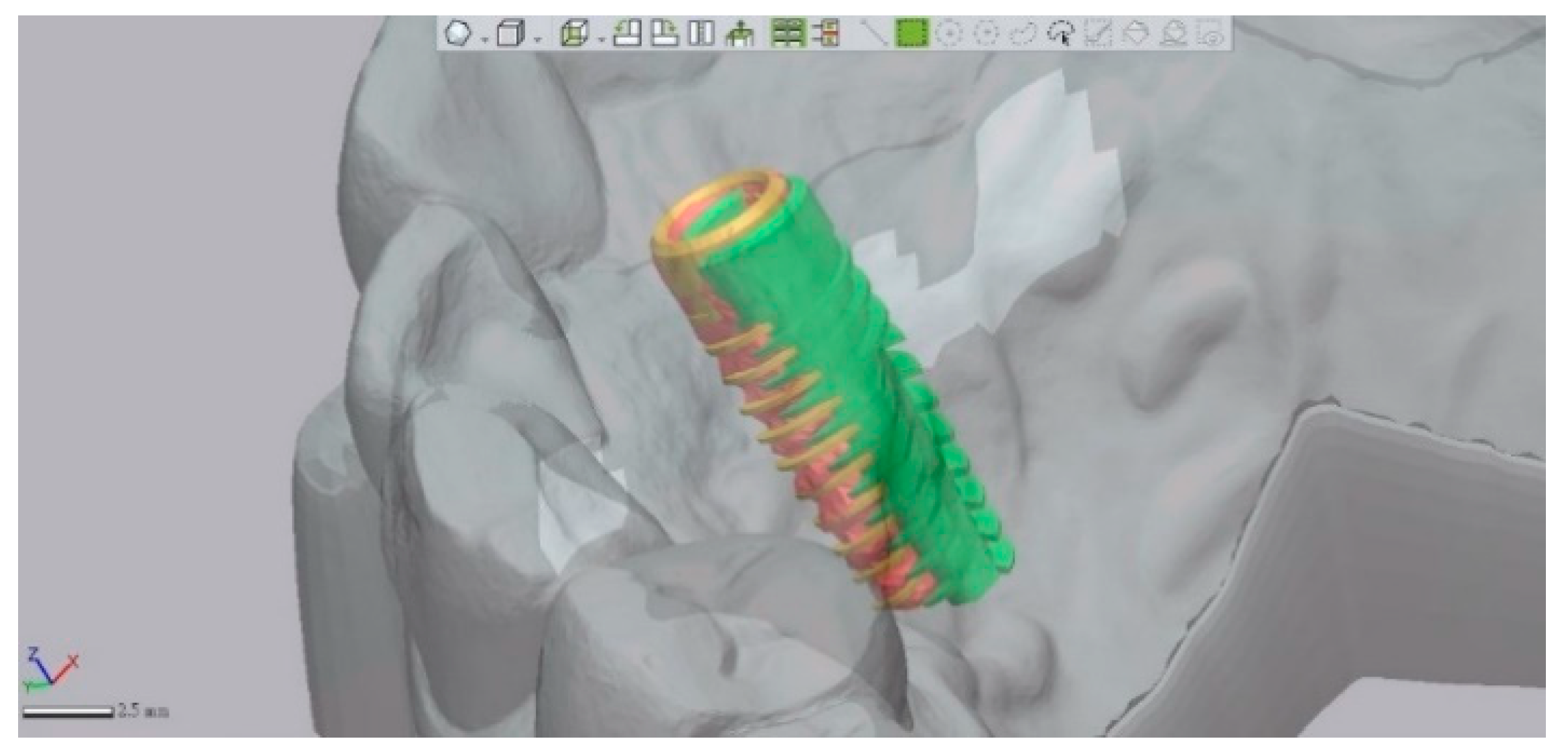 Jcm 09 00980 g005 Jcm 09 00980 g005