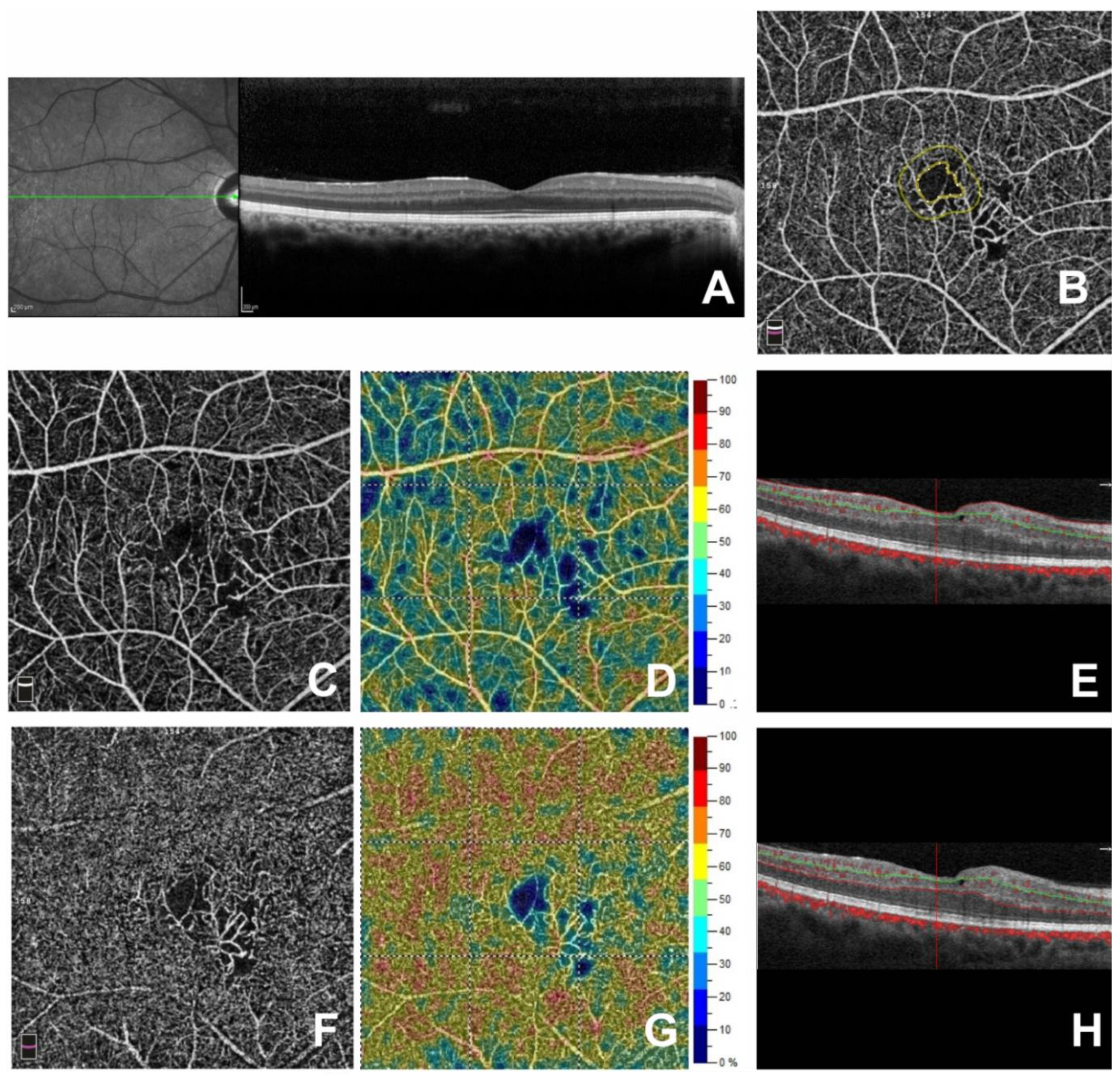 Jcm 09 01618 g002 Jcm 09 01618 g002