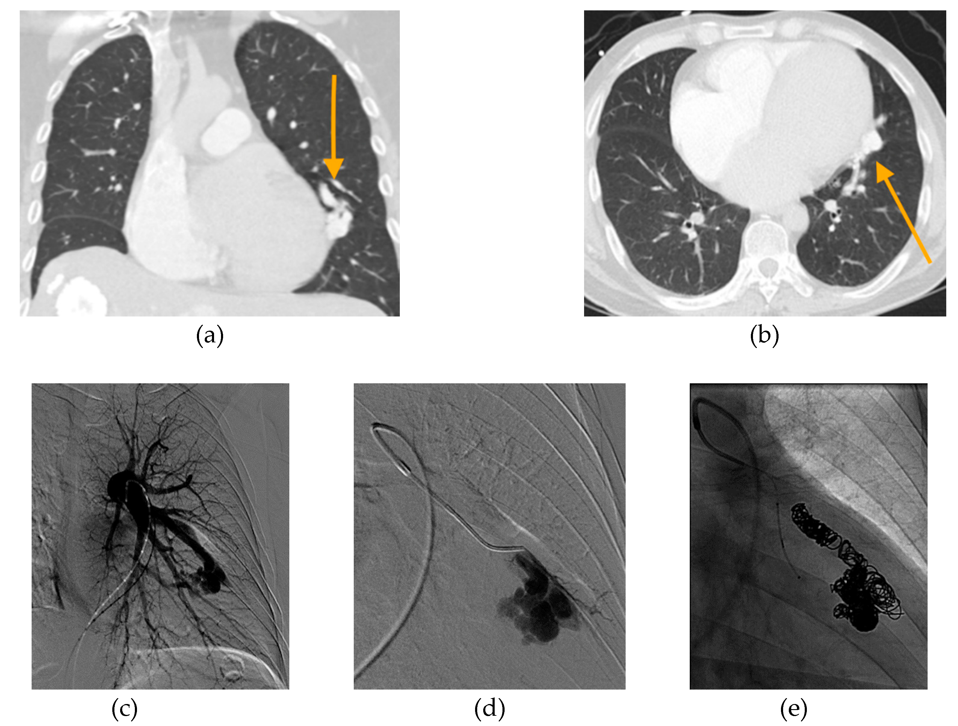 Jcm 09 01927 g005 Jcm 09 01927 g005