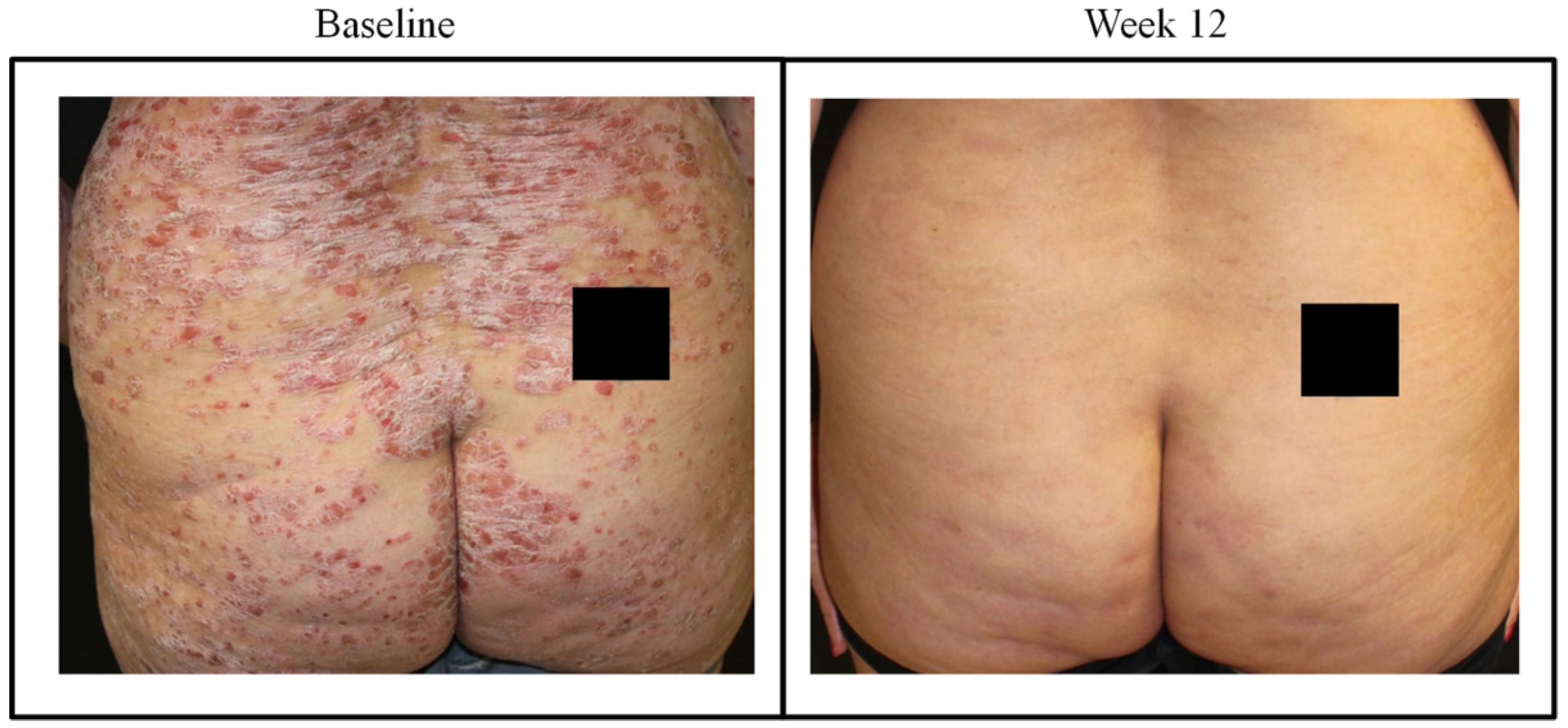 Jcm 09 02170 g004 Jcm 09 02170 g004