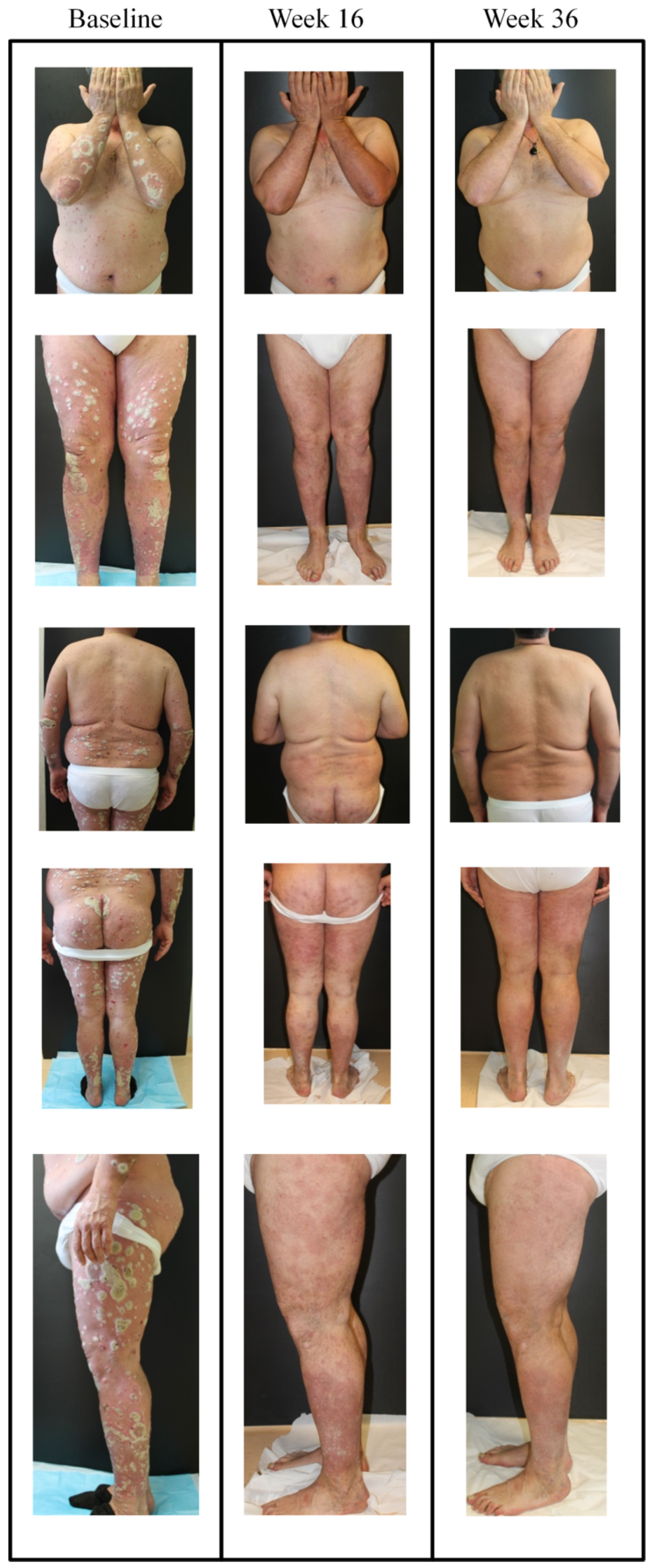 Jcm 09 02170 g005 Jcm 09 02170 g005