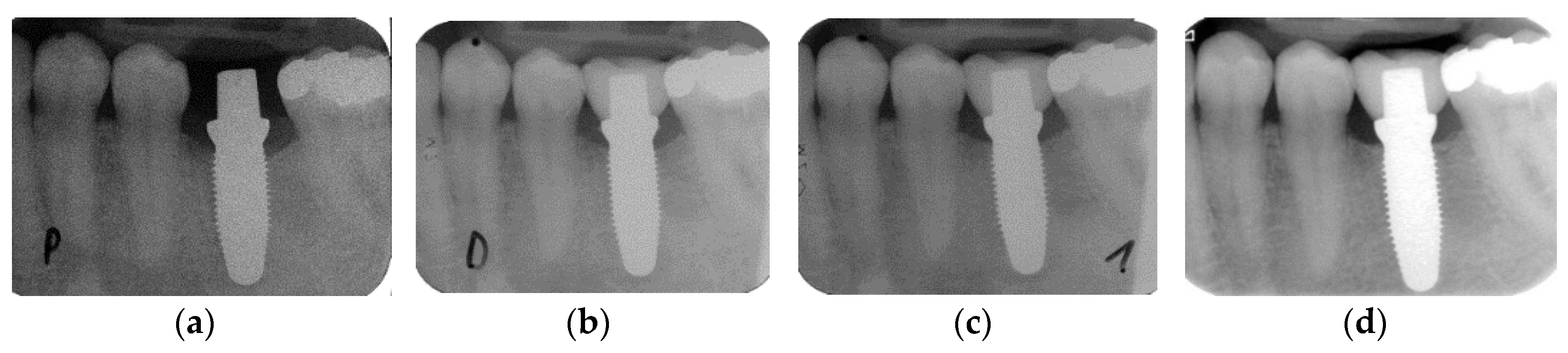 Jcm 09 02585 g002 Jcm 09 02585 g002
