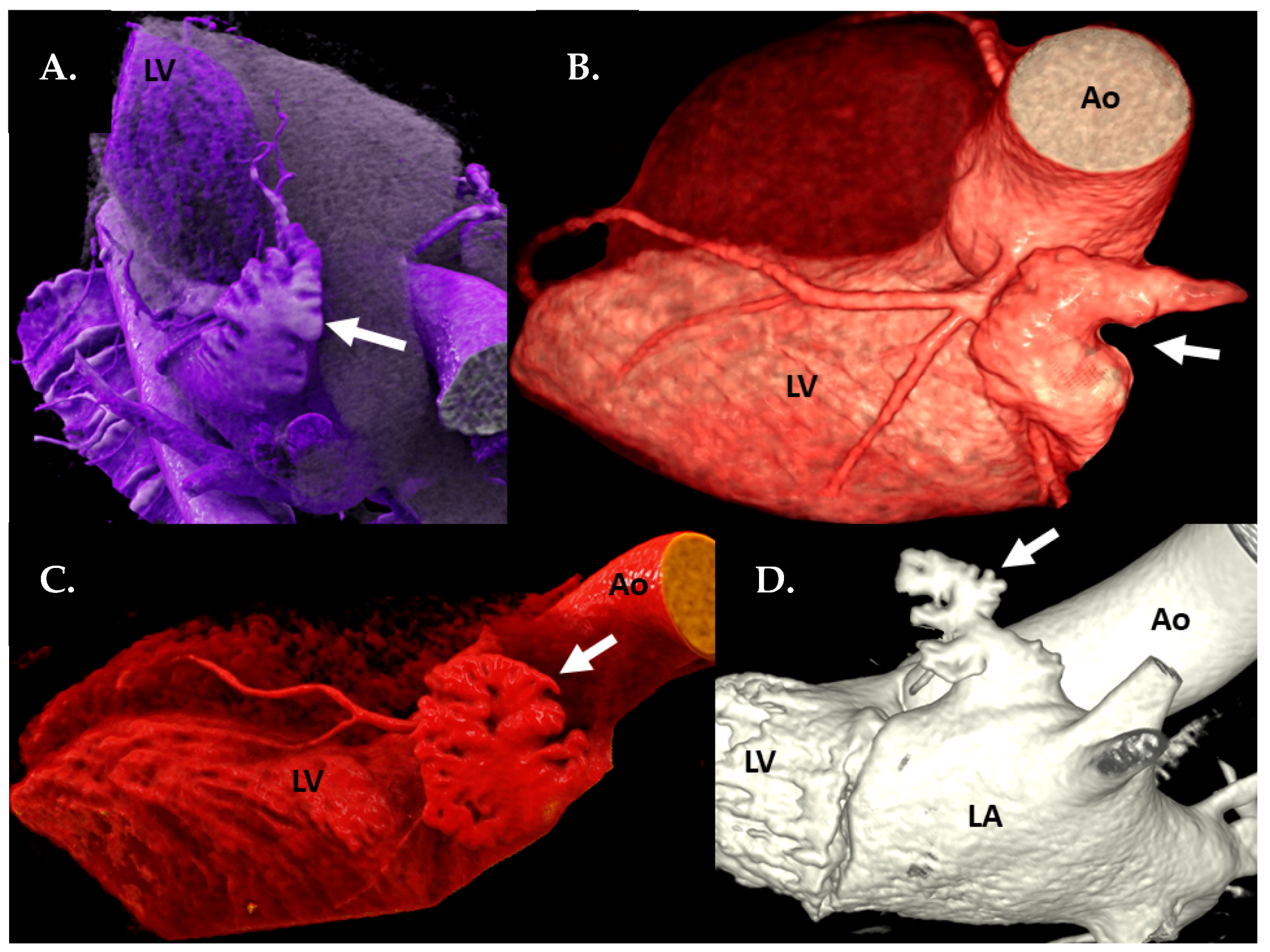 Jcm 09 03944 g001 Jcm 09 03944 g001