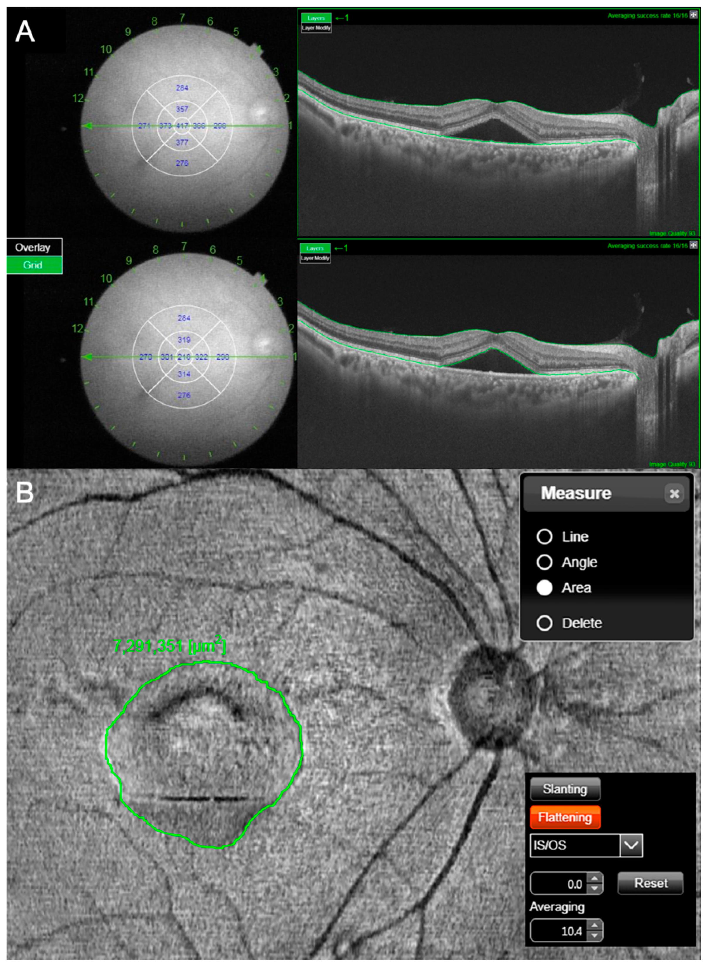 Jcm 10 00045 g002 Jcm 10 00045 g002
