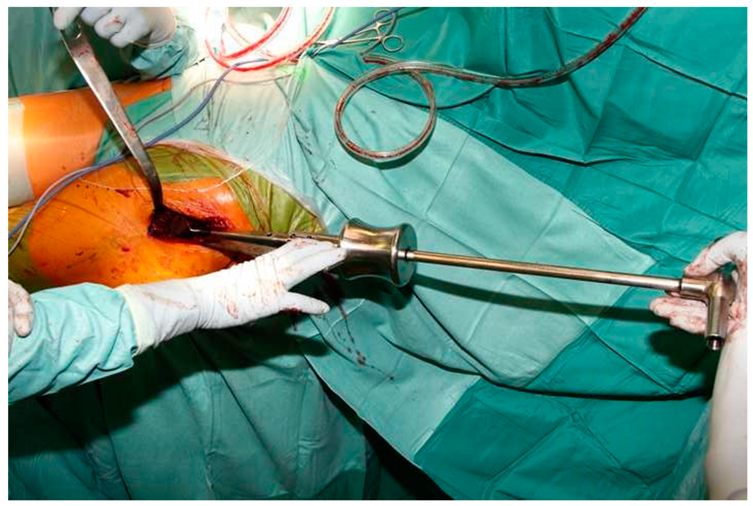 Jcm 10 00337 g001 Jcm 10 00337 g001