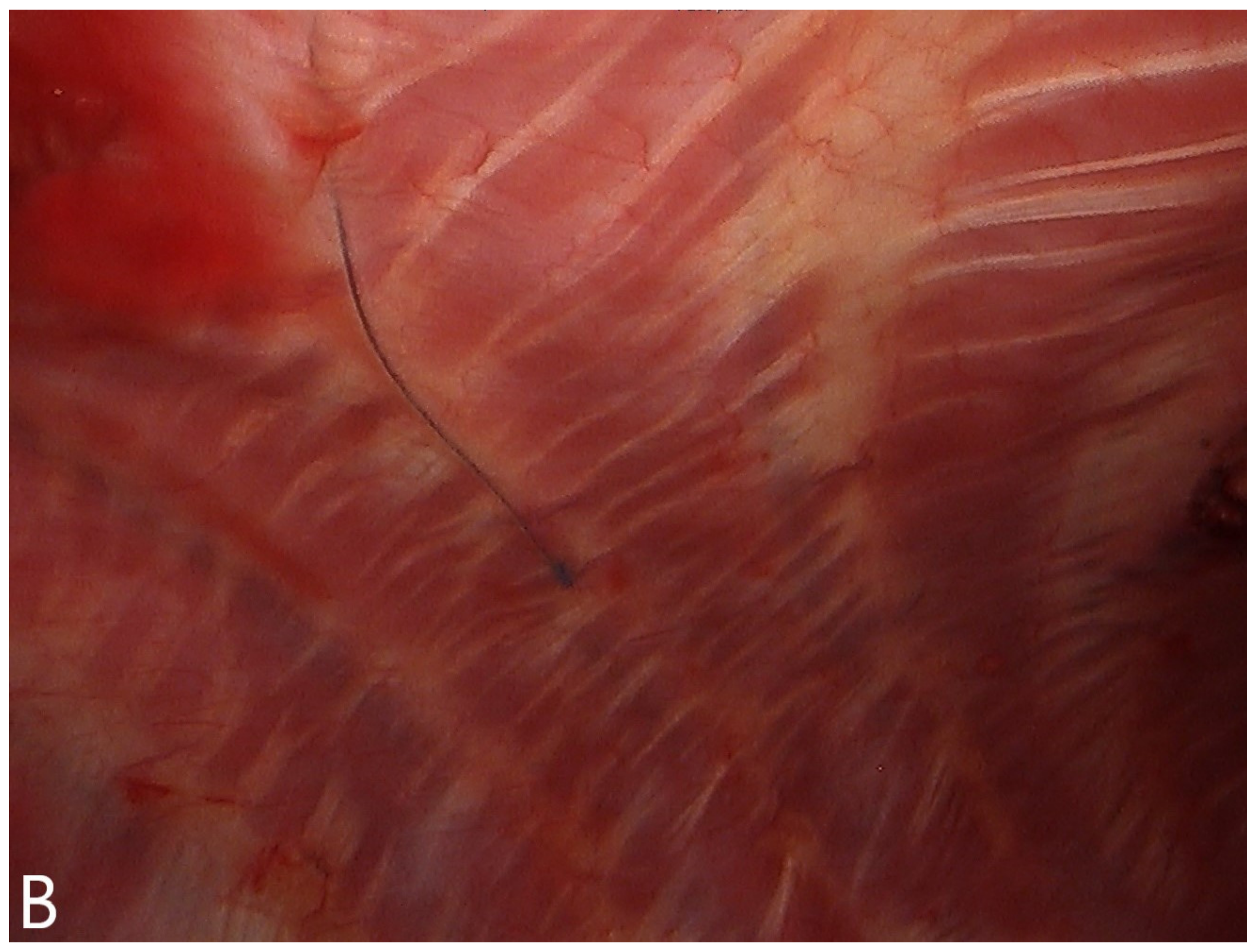 Jcm 10 00372 g001b Jcm 10 00372 g001b