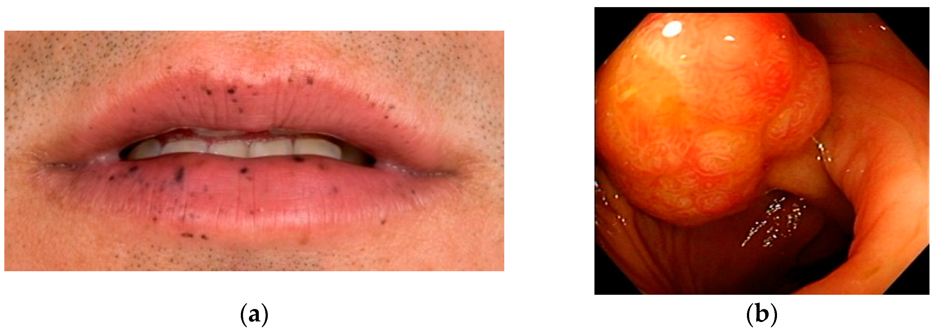 Jcm 10 00473 g001 Jcm 10 00473 g001