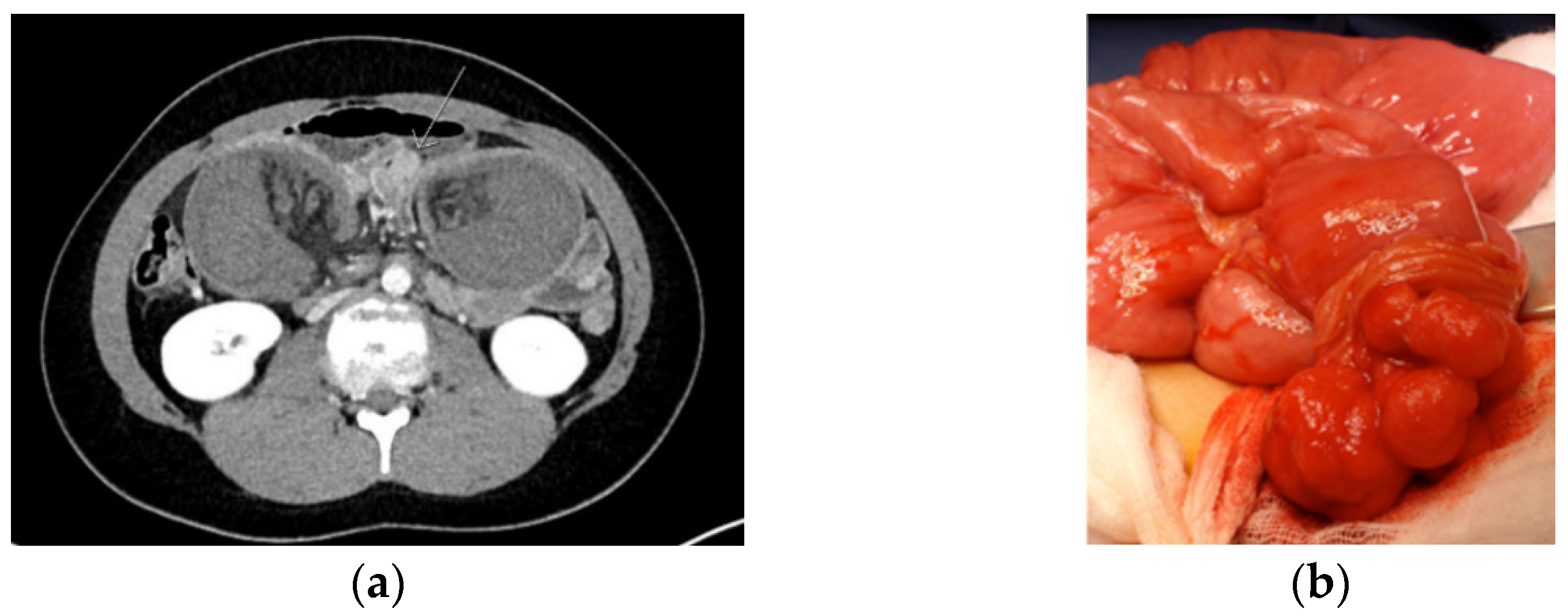 Jcm 10 00473 g002 Jcm 10 00473 g002
