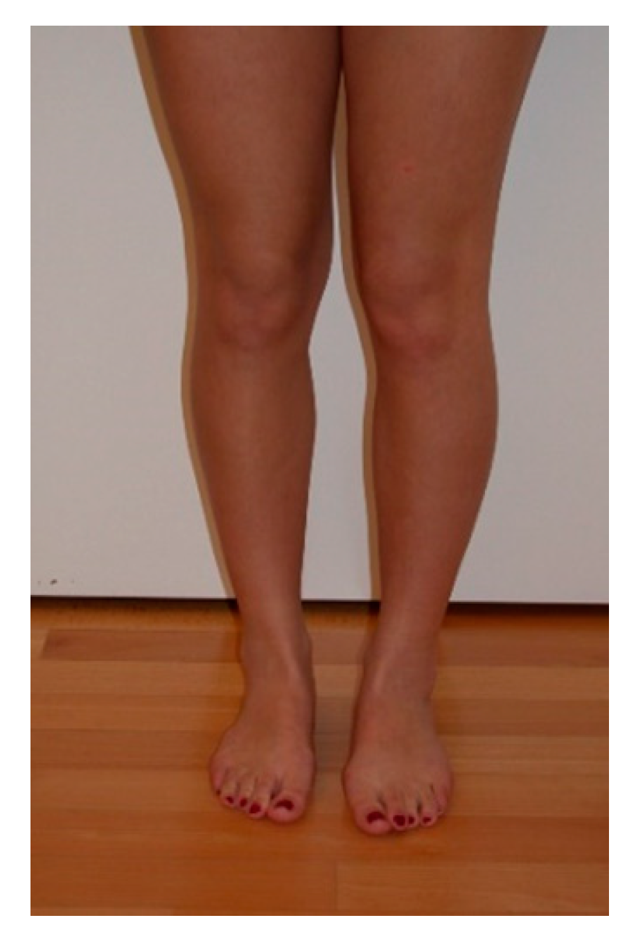 Jcm 10 00474 g001 Jcm 10 00474 g001