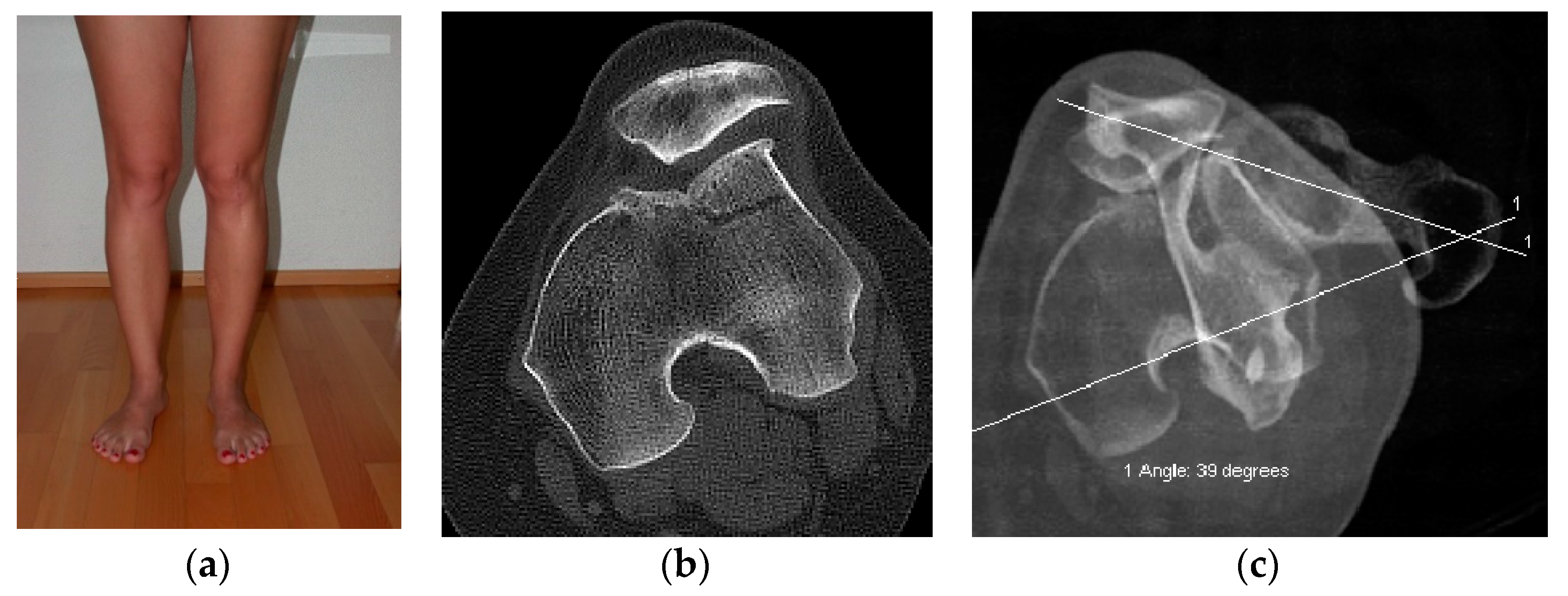 Jcm 10 00474 g003 Jcm 10 00474 g003