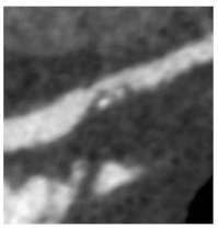 Jcm 10 00521 i005