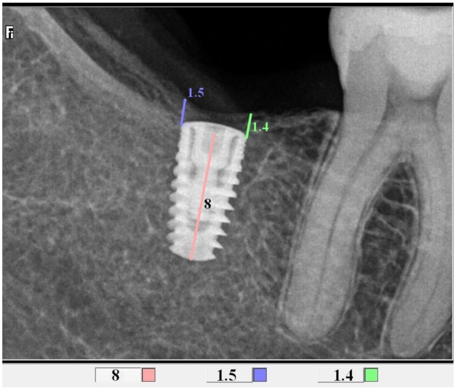 Jcm 10 00526 g003 Jcm 10 00526 g003