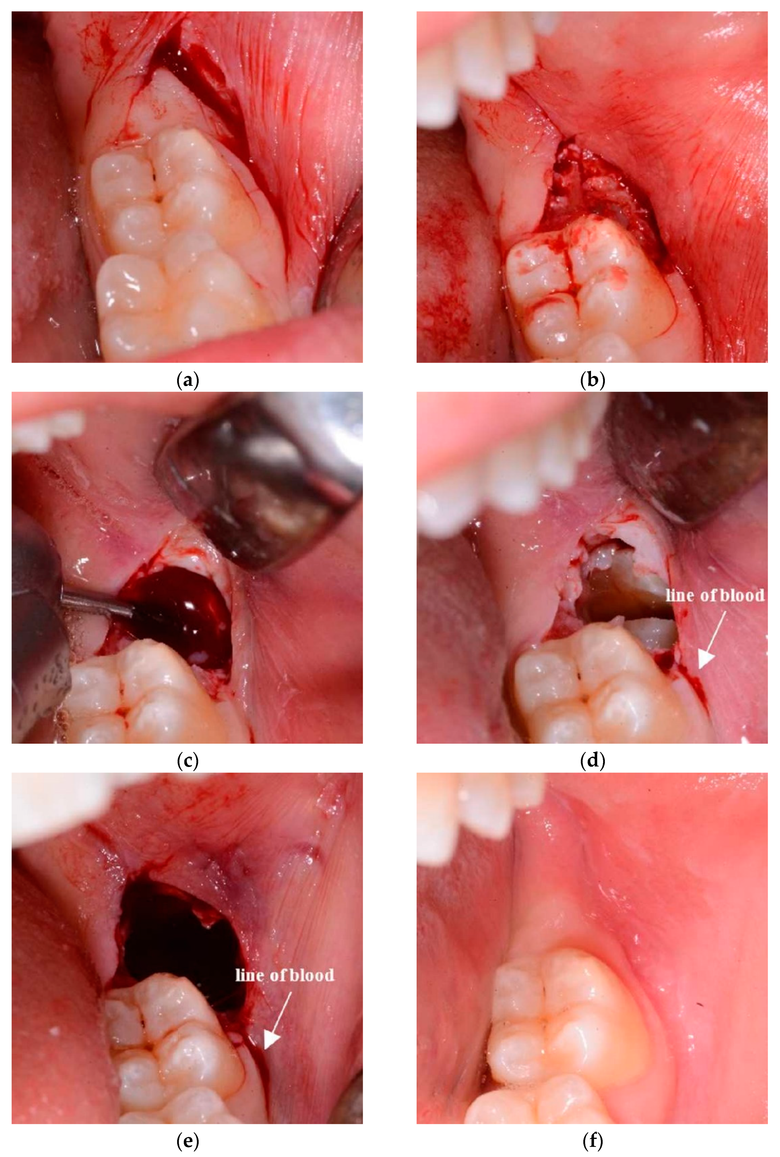 Jcm 10 00593 g002 Jcm 10 00593 g002