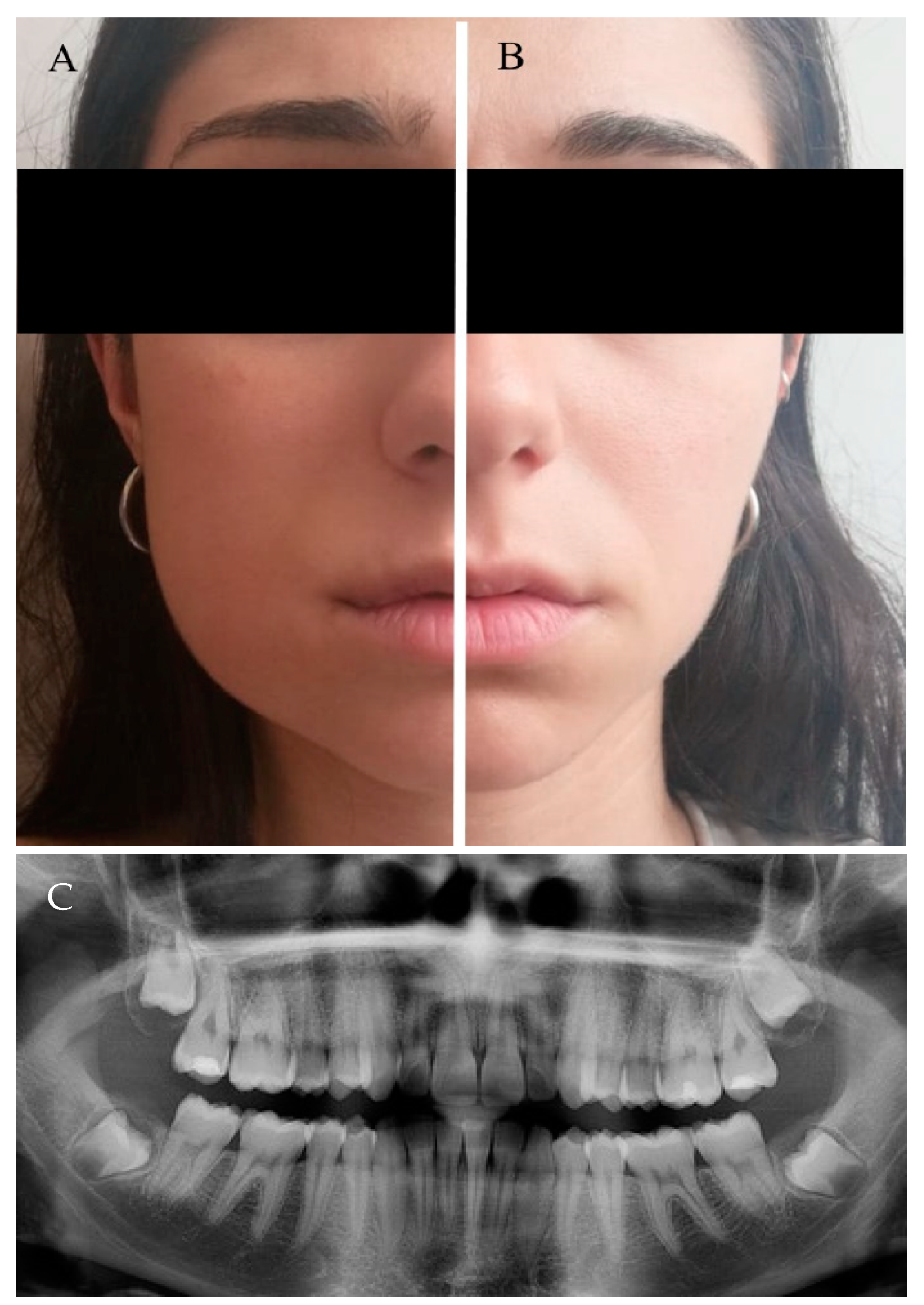 Jcm 10 00593 g003 Jcm 10 00593 g003
