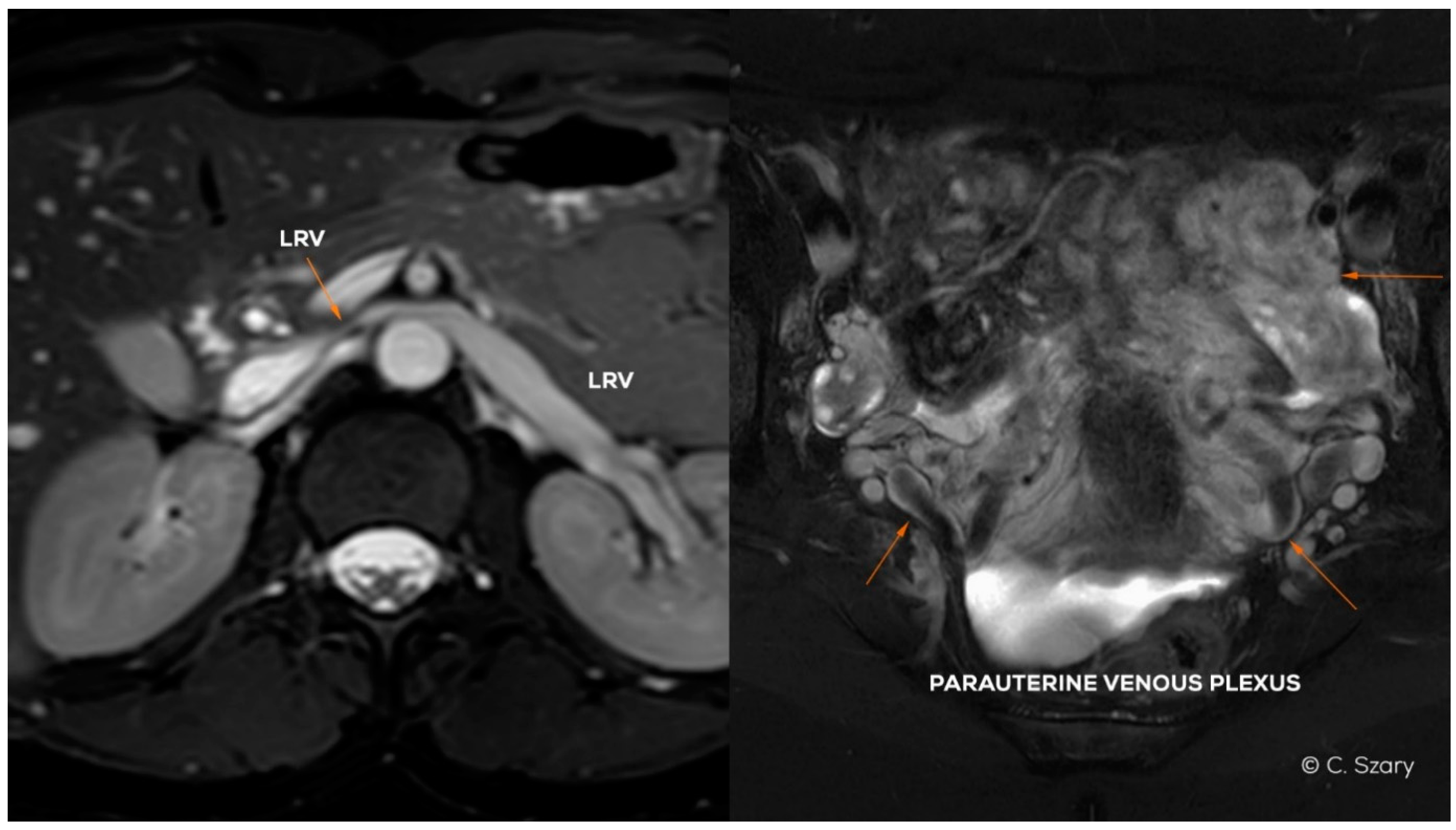 Jcm 10 00646 g004 Jcm 10 00646 g004