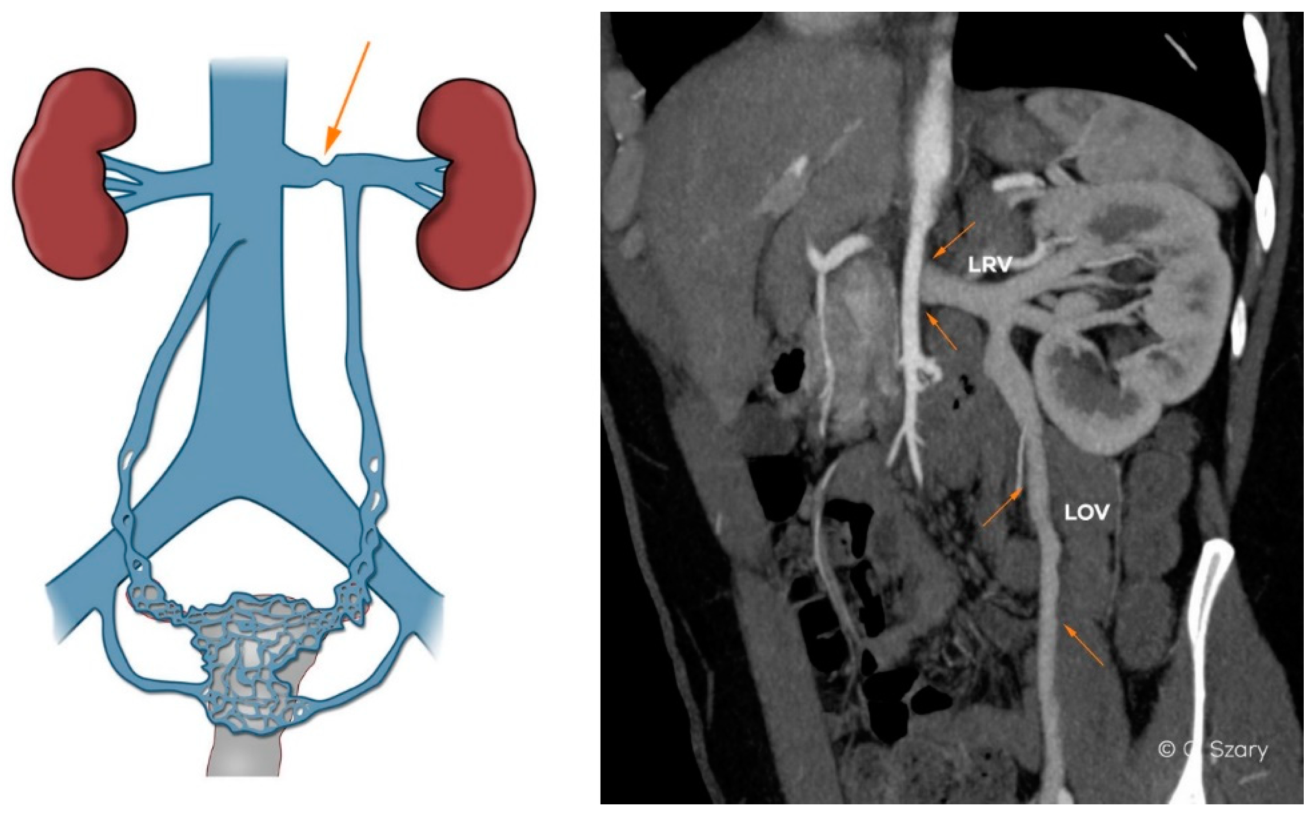 Jcm 10 00646 g005 Jcm 10 00646 g005